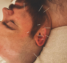 Needle image carousal