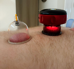 hijama 2 image carousal