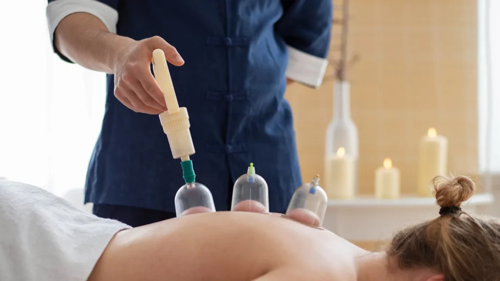 A women giving another women laying on her front getting cupping therapy