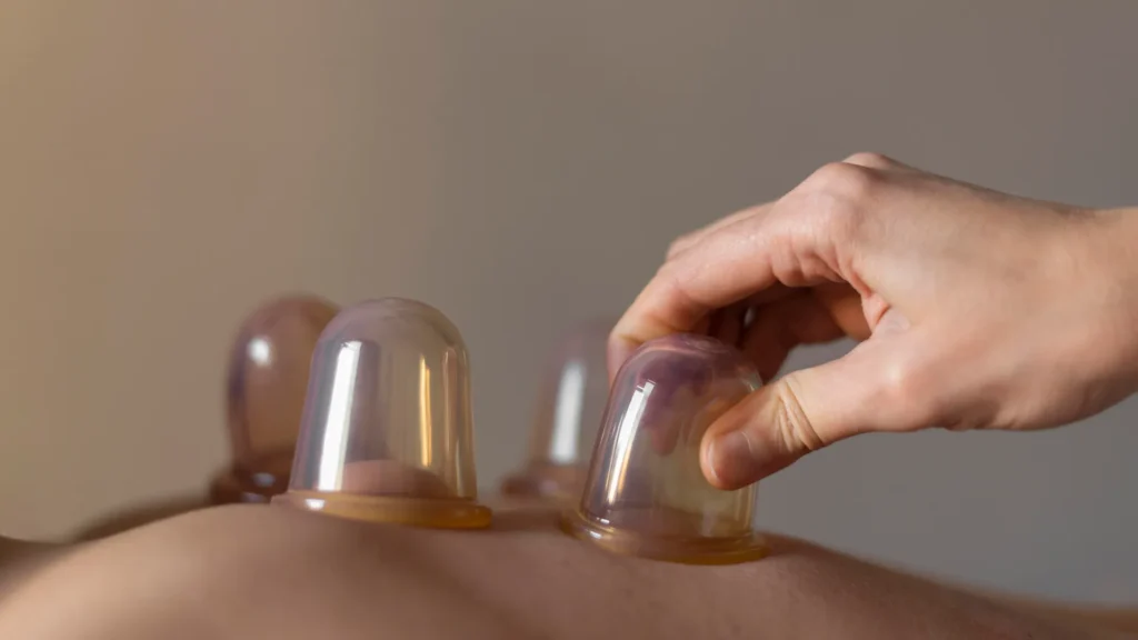 Close up of a person getting cupping therapy