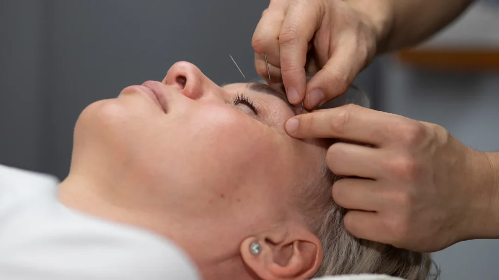 A women getting a botox
